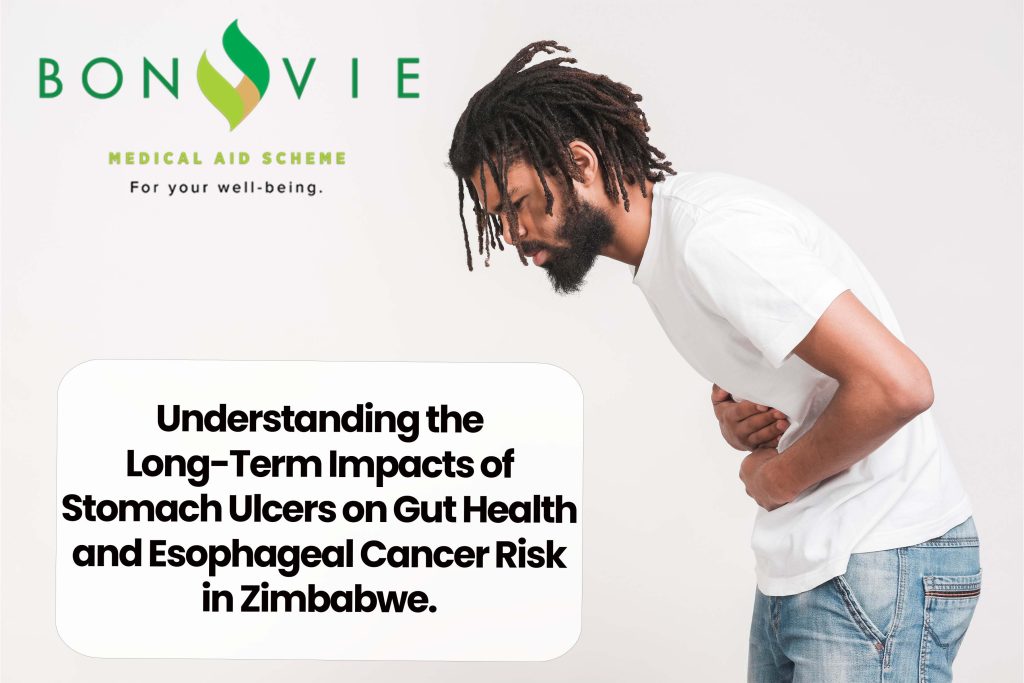 Understanding the Long-Term Impacts of Stomach Ulcers on Gut Health and Esophageal Cancer Risk in Zimbabwe.